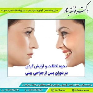 مراقبت های بعد از جراحی بینی