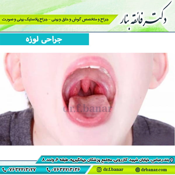 عکس جراحی لوزه