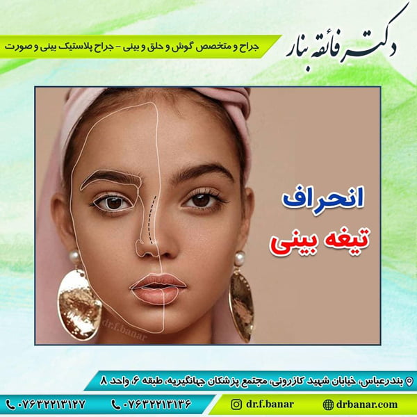 انحراف بینی