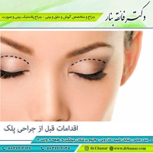 اقدامات-قبل-از-جراحی-پلک