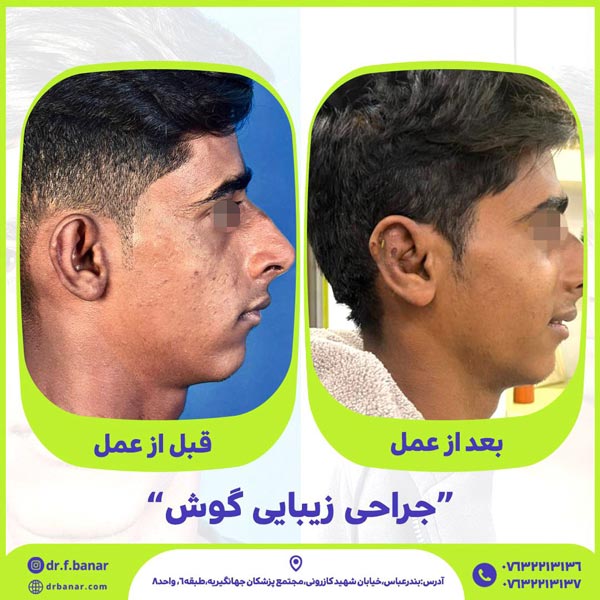 عکس جراحی گوش