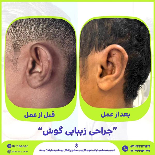 عکس جراحی گوش