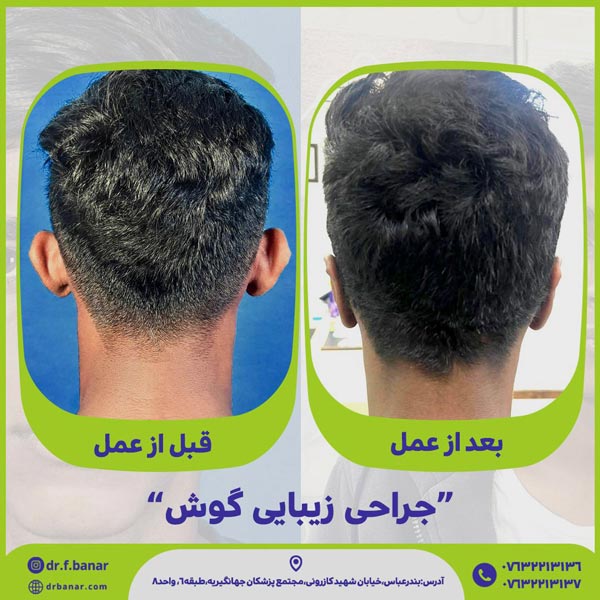 عکس جراحی گوش