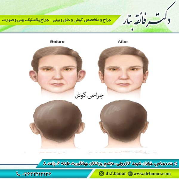 عکس جراحی گوش