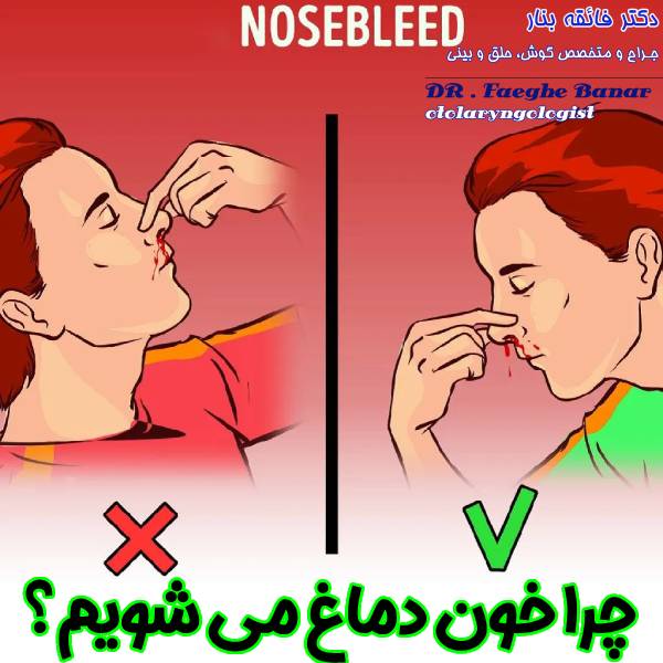 عکس چرا خون دماغ می شویم ؟ دکتر فائقه بنار