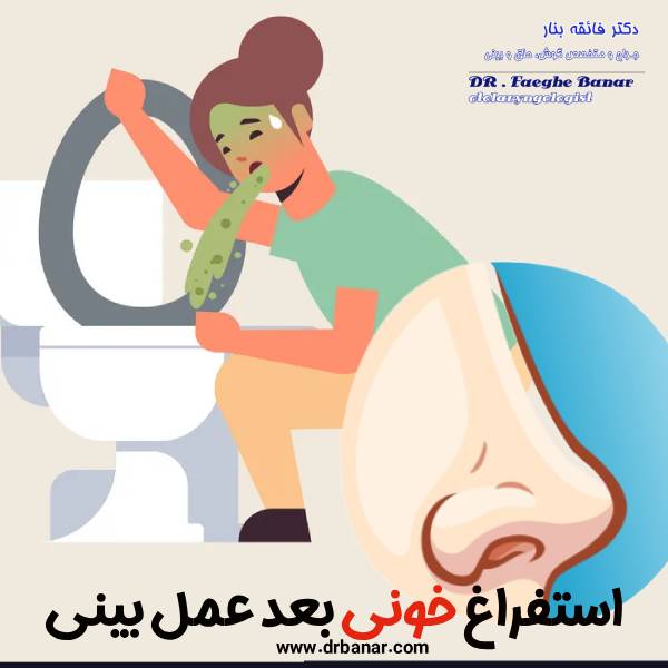 استفراغ خونی بعد عمل بینی - دکتر فائقه بنار