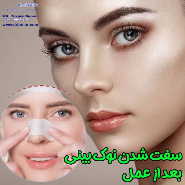 سفت شدن نوک بینی بعد عمل - دکتر فائقه بنار