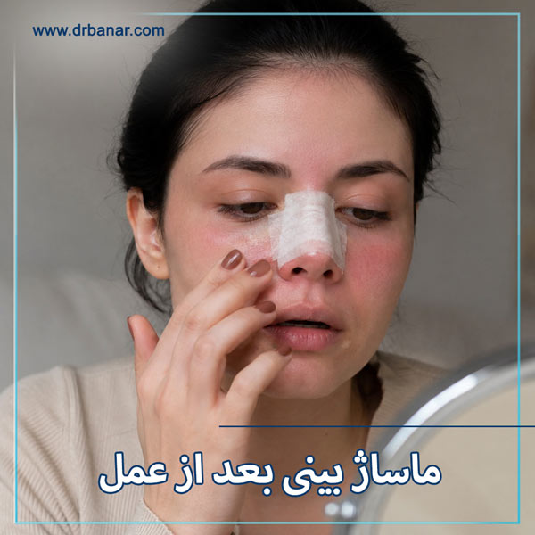 سوزش بینی بعد از عمل + دکتر فائقه بنار