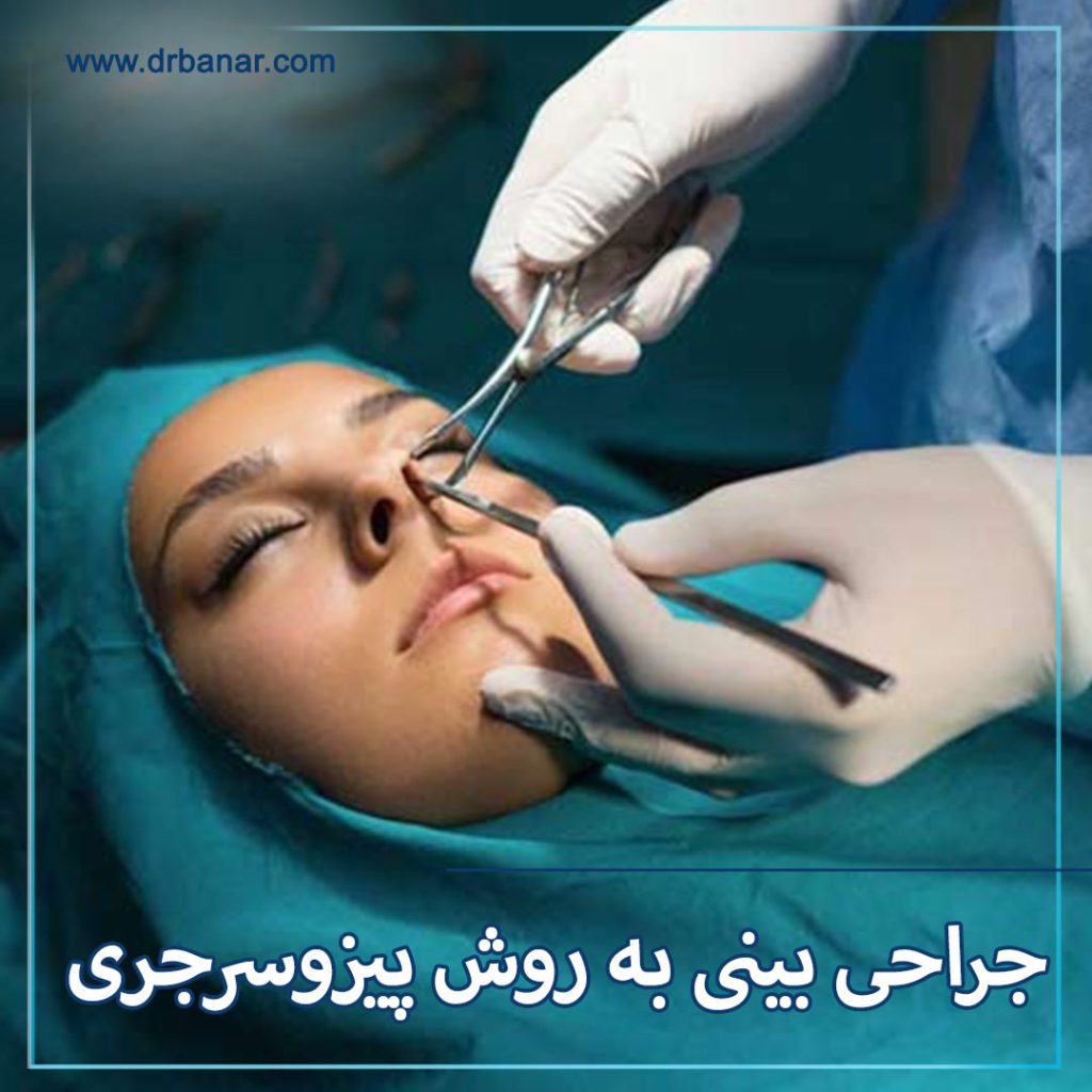 جراحی بینی به روش پیزوسرجری