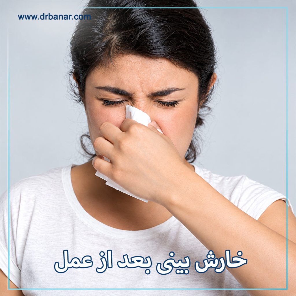 خارش بینی بعد از عمل