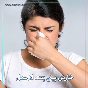 خارش بینی بعد از عمل