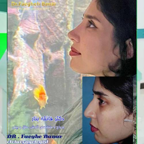 جراحی-بینی-در-بندرعباس-251