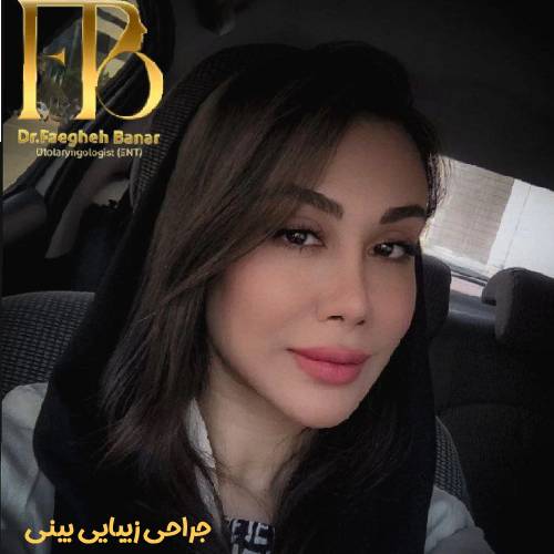 جراحی-بینی-در-بندرعباس-256