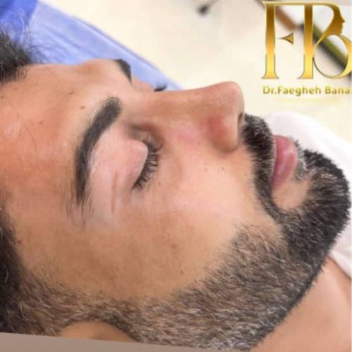 جراحی-بینی-در-بندرعباس-259