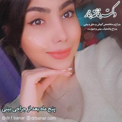 جراحی-بینی-بندرعباس-49
