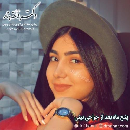 جراحی-بینی-بندرعباس-50