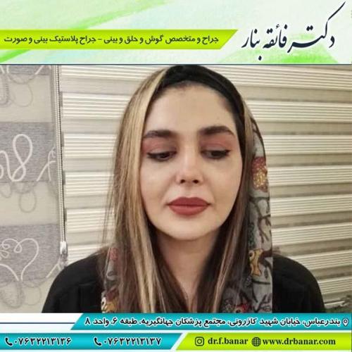جراحی بینی در بندرعباس 187