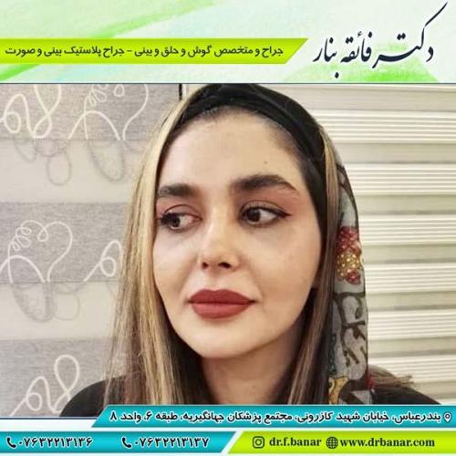 جراحی بینی در بندرعباس 188