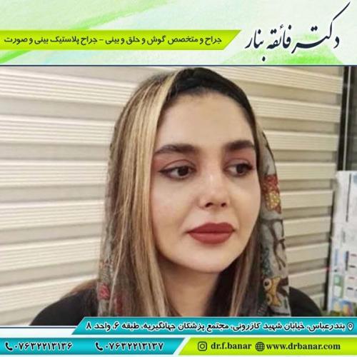 جراحی بینی در بندرعباس 189