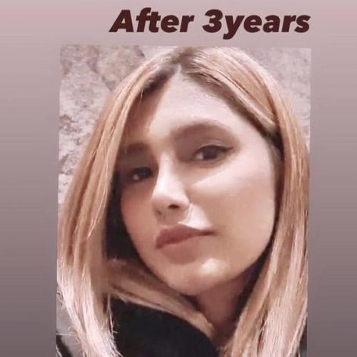 جراحی بینی در بندرعباس 199