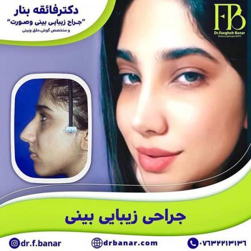 جراحی-بینی-در-بندرعباس230