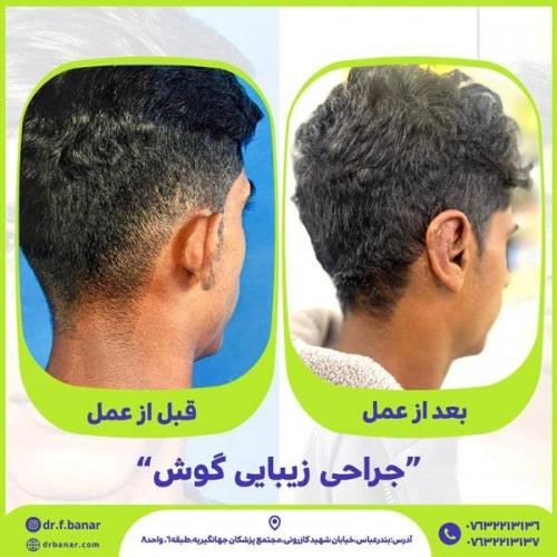 جراحی-گوش-10