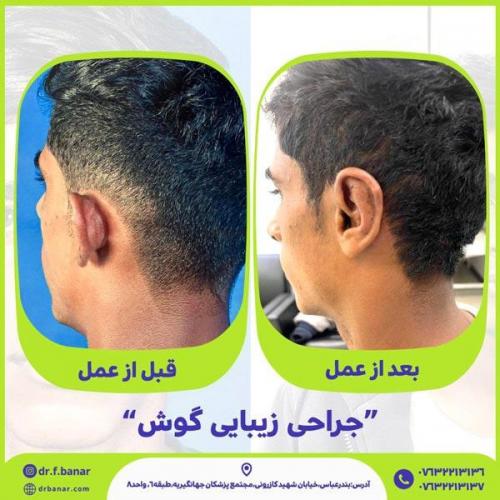 جراحی-گوش-11