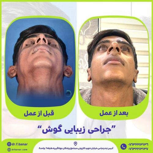 جراحی-گوش-12