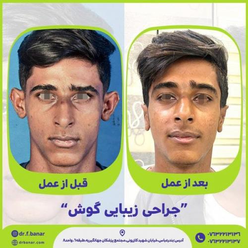 جراحی-گوش-13