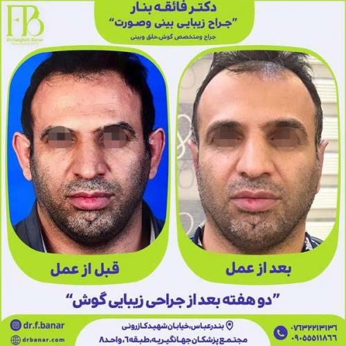 جراحی-گوش-17