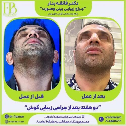 جراحی-گوش-18