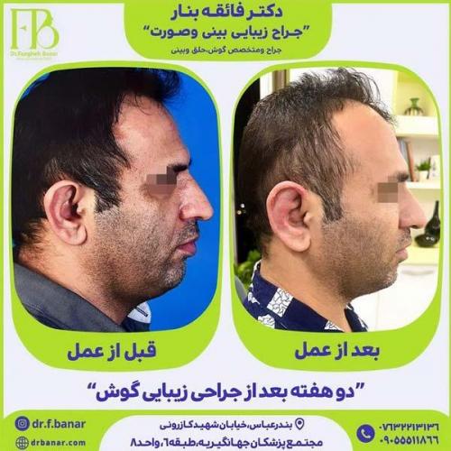 جراحی-گوش-19