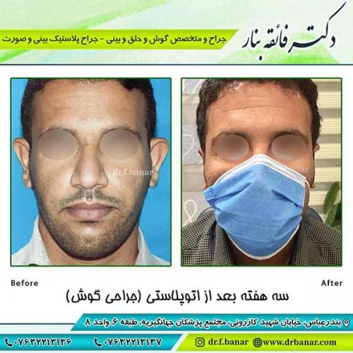 جراحی-گوش-2
