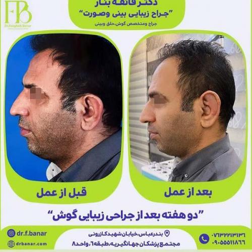 جراحی-گوش-20
