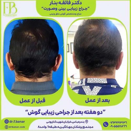 جراحی-گوش-21