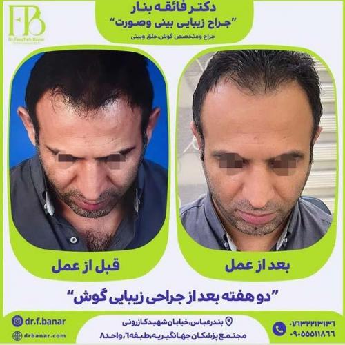 جراحی-گوش-22