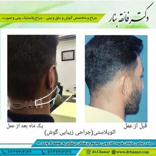 جراحی گوش 5