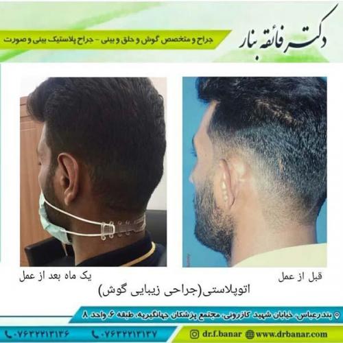 جراحی گوش 6