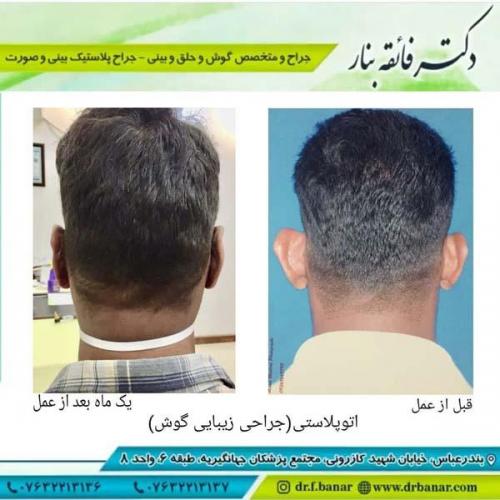 جراحی گوش 7