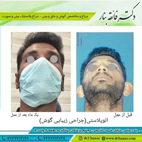 جراحی گوش 8