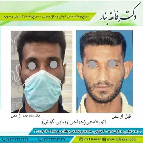 جراحی گوش 9