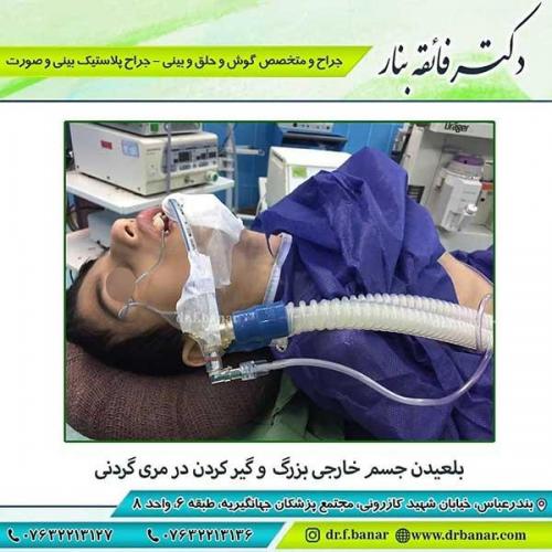 بلعیدن-جسم-خارجی-و-گیر-کردن-در-مرد-گردنی-1